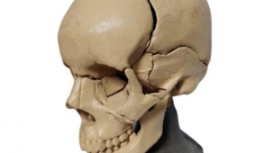 Articulated Fragmented Skull