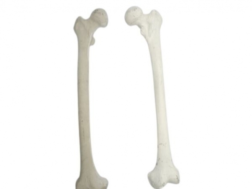 Human Femur Bone