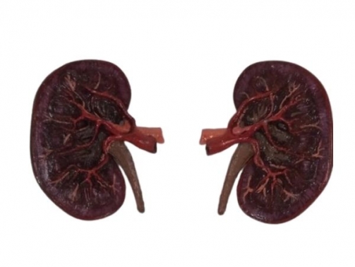 Kidney Model