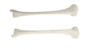 Human Tibia Bone