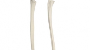 Human Ulna Bone