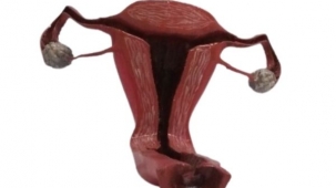 3D Printed Uterus Model