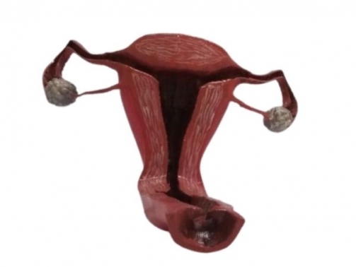 3D Printed Uterus Model